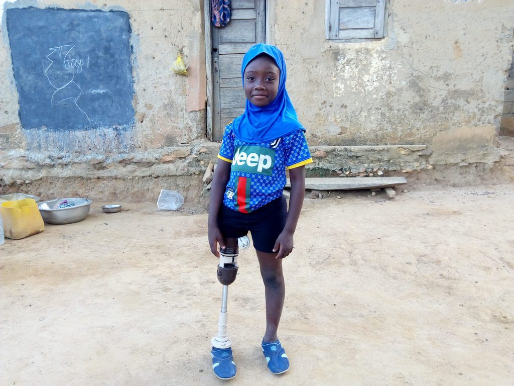 Kadjidja avec sa nouvelle prothèse de jambe.