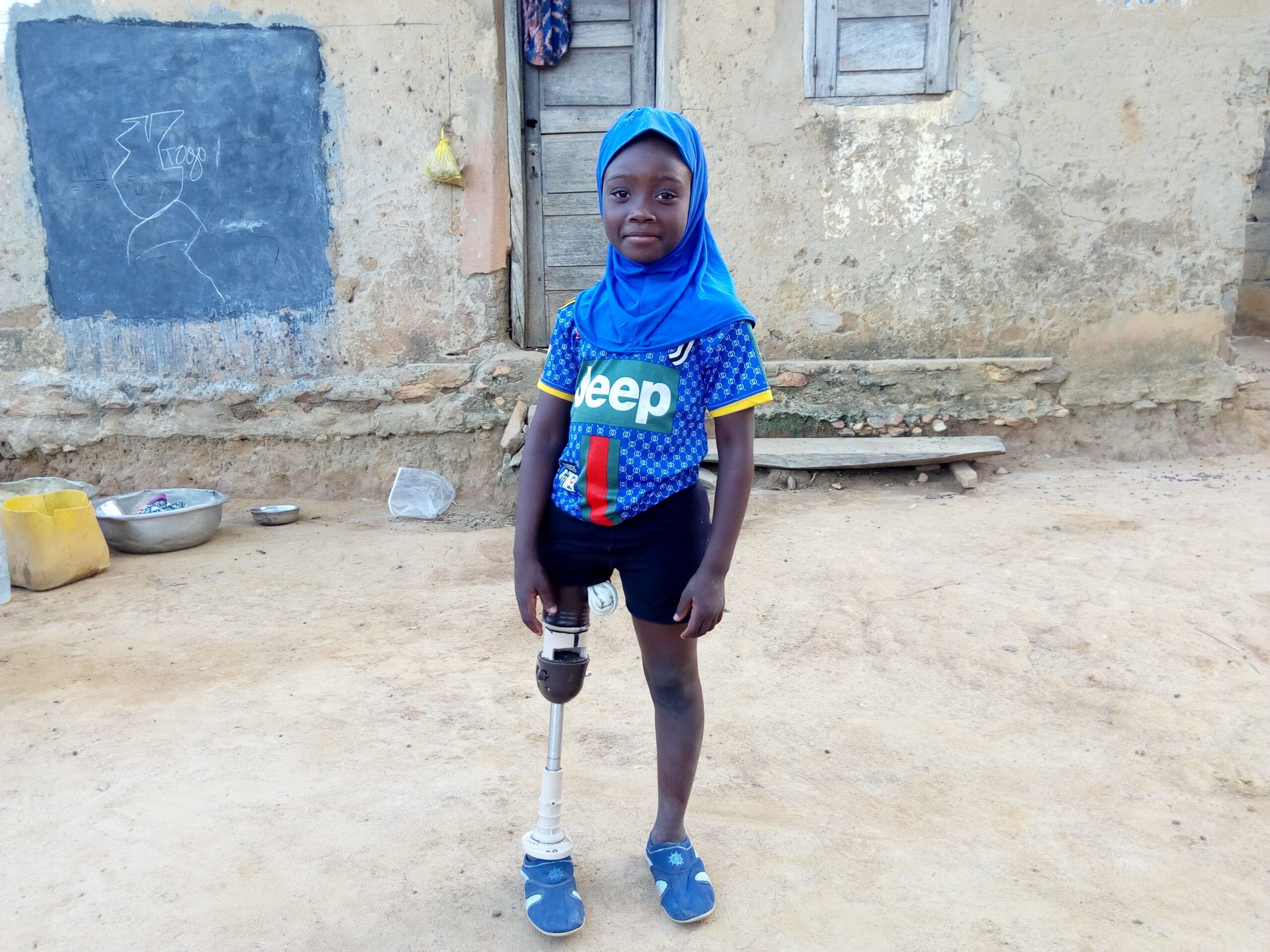 Nigerian woman recycles prosthesis so amputee children walk again